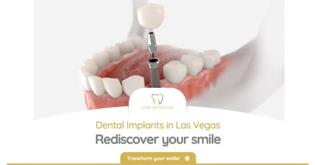 Dental implants in las vegas. Rediscover your smile.